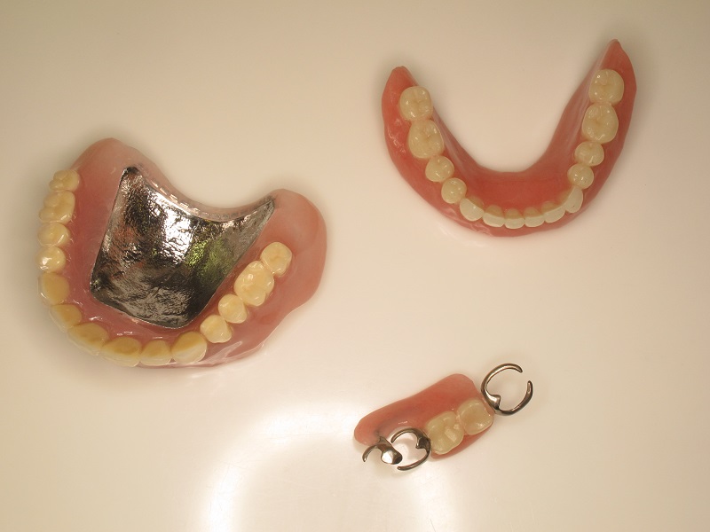 義歯 と は 銀 歯